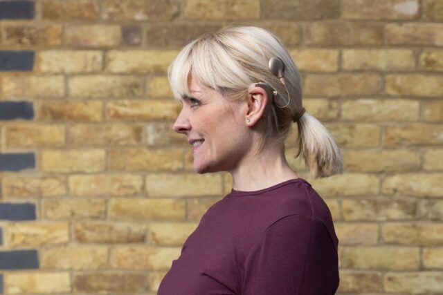 A woman with short blonde hair stands in front of a brick wall. She has a cochlear implant.